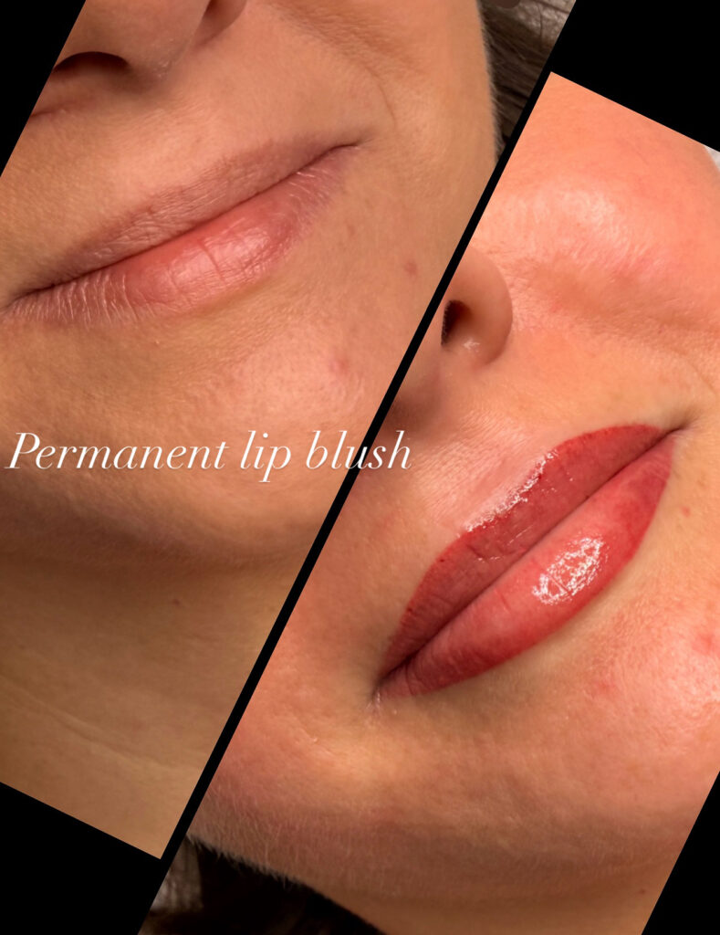 2DB6F246 0262 448E BEA1 962D56EF1BDA