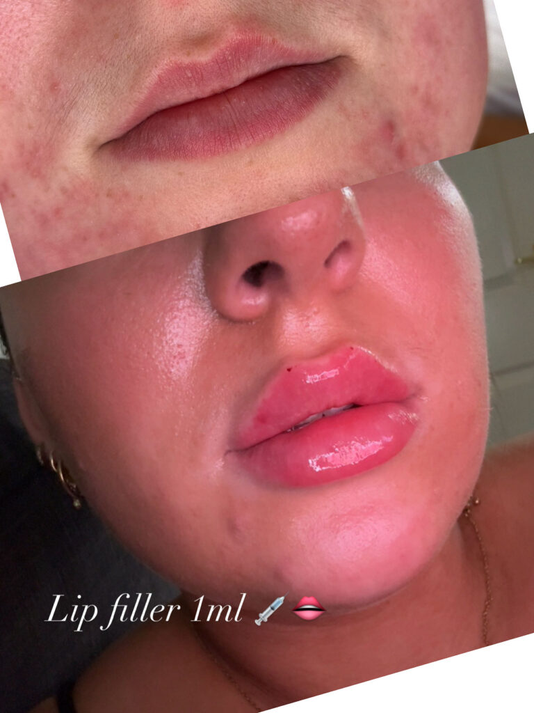 51B87704 3956 4D80 8FBB 7554F1DDD373